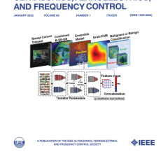 这项研究发表在《IEEE超音波、铁电体和频率控制汇刊》1月刊的头版封面论文上。图片由浦项科技大学提供