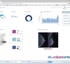 Volpara解决方案和乳房x线摄影教育者推出乳房x线摄影定位培训视频