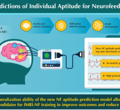 日本国家神经科学技术研究所的科学家开发的新型神经反馈(NF)能力预测模型具有高度的泛化能力，提供了一种快速、简单和无创的方法，可以在临床环境中筛选fMRI-NF训练最有益的候选人。图片由奈良科学技术学院提供