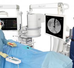 NuCART, CompView医疗，移动臂系统，导管室，混合手术室