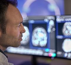 智能磁共振加速软件有助于提高磁共振部门的效率，以3倍的扫描速度，并实现更高质量的图像分辨率和更大的诊断信心