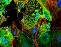 圣路易斯华盛顿大学医学院的一项研究提供了证据，证明冠状病毒可以入侵并复制心肌细胞，导致细胞死亡并干扰心肌收缩。工程心脏组织图像显示感染COVID-19 (SARS-CoV-2)的人类心肌细胞(红色)(绿色)。阅读更多。图片由莉娜·格林伯格提供。