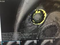 这是富士胶片本周在HIMSS 2019大会上发布的新的心脏MRI分析软件的一个样本。