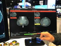 乳房x光检查的人工智能。该系统将人工智能分析显示在放射科医生的另一个屏幕上，而不是将其嵌入乳房x光片上。这使得放射科医生在阅读研究报告后可以作为第二对眼睛进行检查。
