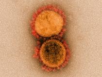 美国国立卫生研究院(NIH)用高倍显微镜拍摄的两种冠状病毒(COVID-19)图像。