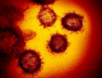 美国国立卫生研究院(NIH)用高倍显微镜拍摄的两种冠状病毒(COVID-19)图像。
