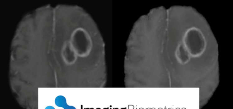 Patented artificial intelligence technology eliminates the need for gadolinium-based contrast agents in MRI exams
