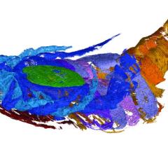 通过计算机断层扫描(CT)成像,西弗吉尼亚大学地质学家詹姆斯Lamsdell领导的一个团队发现的证据在340年前的海洋蝎子空气呼吸,或广翅鲎。这是一个扫描的标本