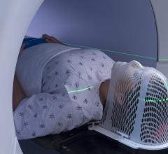 人暴露于低剂量的电离辐射有一个额外的,但温和,在他们的一生中患心脏病的风险,根据一项新的研究