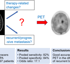 一个新的或增加对比度增强T1 MRI代表治疗或进步的结果/复发性肿瘤吗?这种常见的临床难题可以通过氨基酸来解决宠物具有良好的诊断准确性。