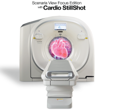 与传统的图像重建方法相比，Cardio StillShot通过检测和纠正心脏运动，使时间分辨率提高了6倍