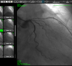 WebPAX、心脏成像技术、pac、心脏pac,回波成像