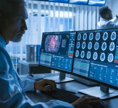 增高扫描提供了一个更大的核磁共振技术专家和医生的详细级别。